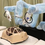 Pierwszy robot chirurgiczny ze sprzężeniem zwrotnym