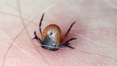 Pierwszy śmiertelny przypadek wirusa oz przenoszonego przez kleszcze 