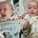 Pierwszy taki zabieg u bliźniąt. Poruszające podziękowania rodziców