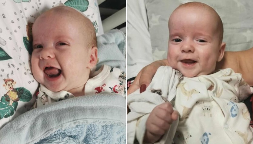 Pierwszy taki zabieg u bliźniąt. Poruszające podziękowania rodziców