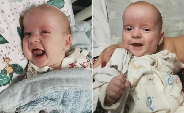 Pierwszy taki zabieg u bliźniąt. Poruszające podziękowania rodziców