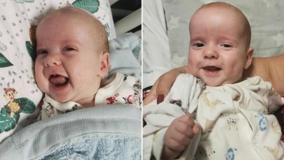 Pierwszy taki zabieg u bliźniąt. Poruszające podziękowania rodziców