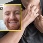 Pierwszym objawem była dziwna wysypka. Usłyszał, że zostały mu trzy tygodnie życia