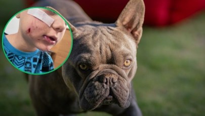 ​Pies pogryzł twarz 4-letniego Frania. Rodzice szukają właściciela czworonoga