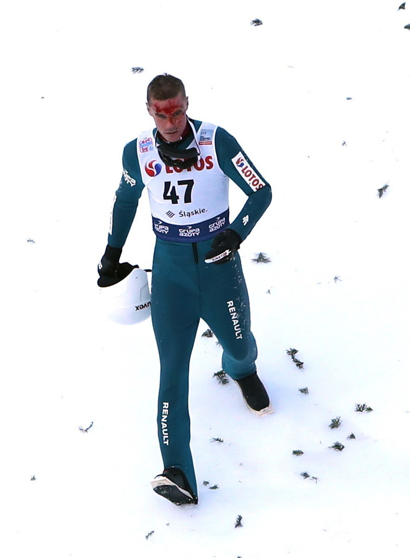 Piotr Żyła po upadku podczas pierwszej serii skoków zawodów Pucharu Świata w skokach narciarskich w Wiśle /Grzegorz Momot /PAP