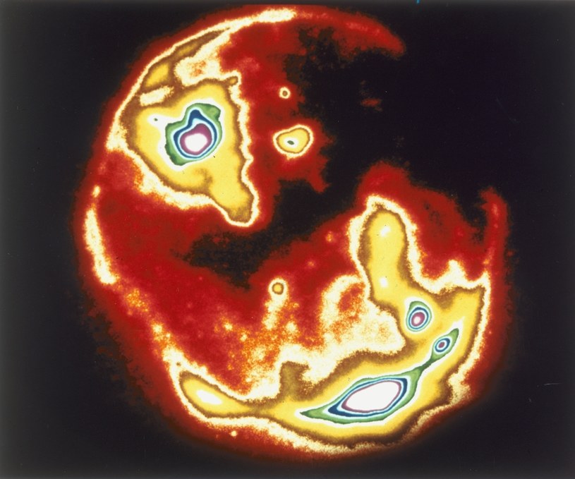 Plazmosfera nie jest niezniszczalna. Może uszkodzić ją np. wybuch słoneczny. Na zdjęciu: fotografia Słońca wykonana z użyciem promieni rentgenowskich /Oxford Science Archive/Print Collector /Getty Images