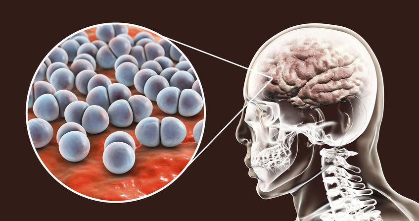 Pneumokiki atakują mózg /&copy;123RF/PICSEL