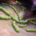 Pneumokoki: Objawy, choroby i leczenie