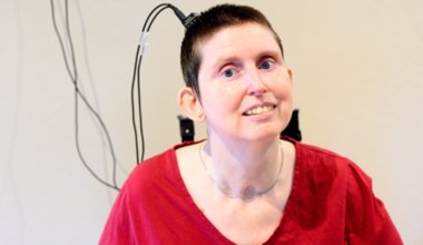 Po 18 latach odzyskała głos dzięki implantowi. "W końcu żyję"