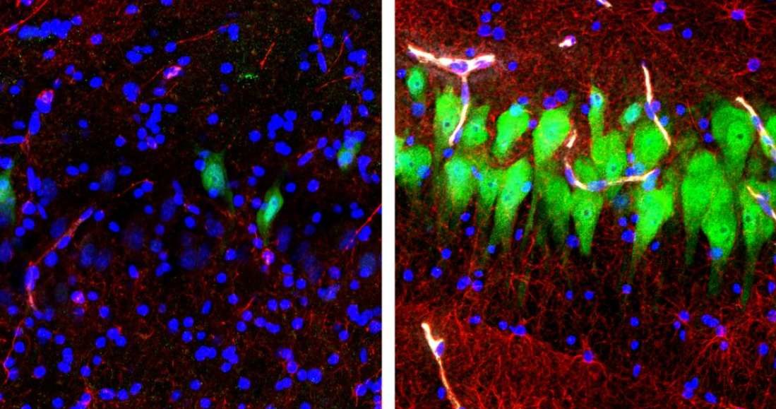 Po lewej region hipokampa CA3 10 godzin po śmierci, a po prawej ten sam region poddany "wskrzeszeniu". Neurony są wybarwione na zielono, astrocyty na czerwono, a jądra komórkowe na niebiesko /Fot. Uniwersytet Yale /materiały prasowe