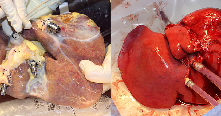 Po lewej wątroba, której nie poddano perfuzji, po prawej organ po kuracji w maszynie /materiały prasowe