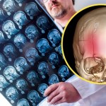 Po tym poznasz, że w głowie tkwi krwiak. Objawy w oku lub na ręce