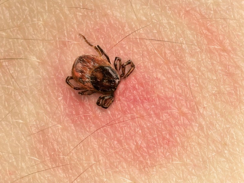 Po ukąszeniu dziecka przez kleszcza uwagę rodziców powinny zwrócić niespecyficzne objawy /123RF/PICSEL