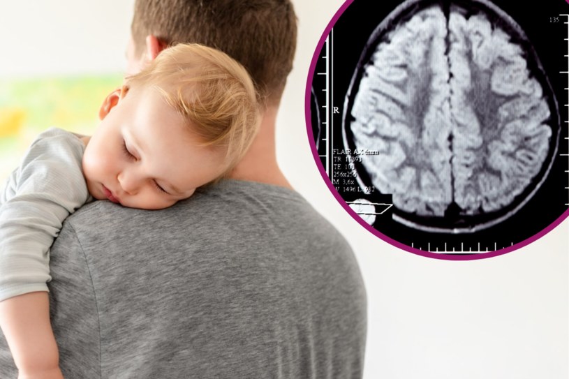 Po urodzeniu dziecka dochodzi do zmian strukturalnych mózgu w obszarze odpowiedzialnym za odbieranie sygnałów społecznych. /123RF/PICSEL