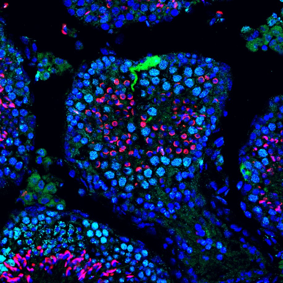 Po wprowadzeniu mRNA kodującego ulepszone zielone białko fluorescencyjne (EGFP) widać silną fluorescencję w komórkach Sertoliego /Mito Kanatsu-Shinohara /Materiały prasowe