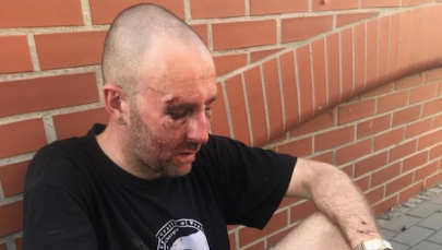 Pobicie dziennikarza we Wrocławiu. Policja zatrzymała 28-latka