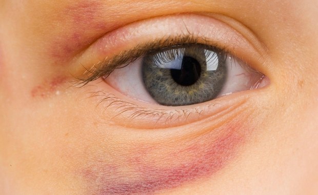 Pobił 4-letniego syna, na kilka dni zamknął go w łazience. Areszt dla ojca