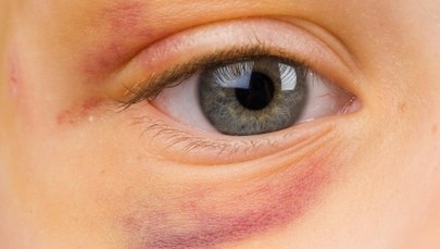 Pobił 4-letniego syna, na kilka dni zamknął go w łazience. Areszt dla ojca