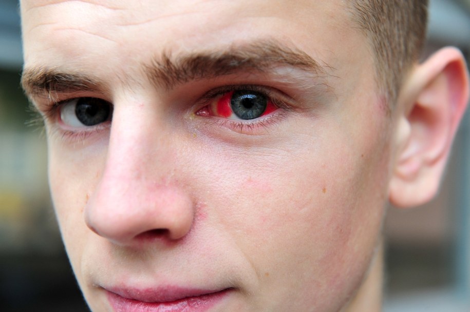 Pobity 20-latek Grzegorz Mielczarek /Marcin Bielecki /PAP