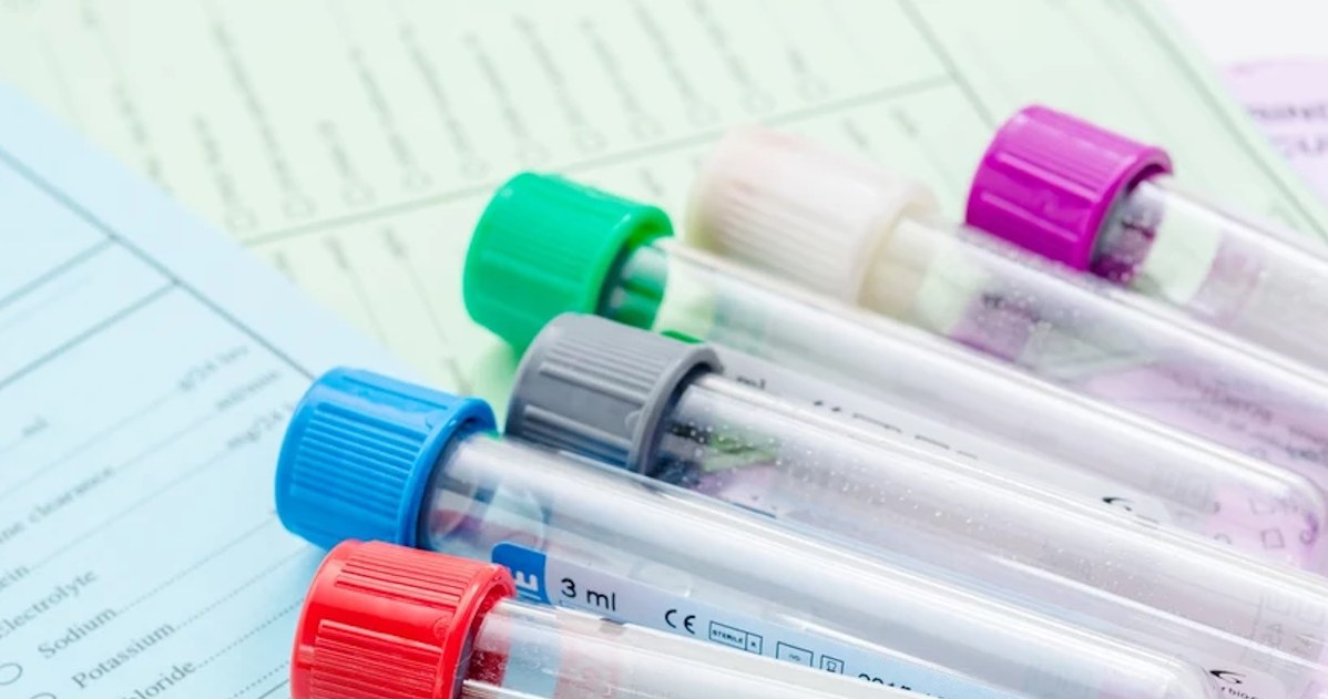 Pobranie krwi to jedno z podstawowych badań refundowanych przez NFZ. To szybka i skuteczna metoda oceny pracy organizmu /123RF/PICSEL