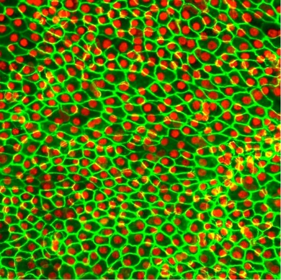 Pochodzące z komórek miacierzystych komórki nabłonka barwnikowego siatkówki / Dennis Clegg, UCSB Center for Stem Cell Biology and Engineering /Materiały prasowe