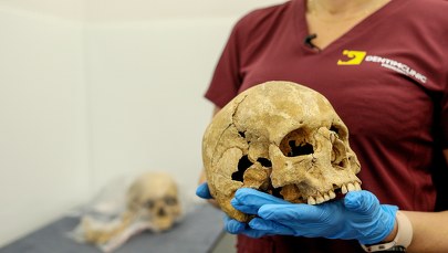 Pochówek „wampirów” w Gliwicach. Co mówią dentyści?