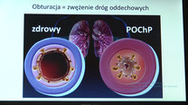 POChP stanie się trzecią przyczyną zgonów na świecie?