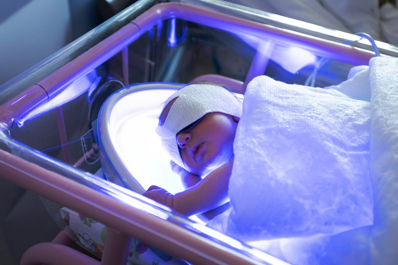 Podczas fototerapii, malucha z żółtaczką umieszcza się w specjalnym inkubatorze /123RF/PICSEL