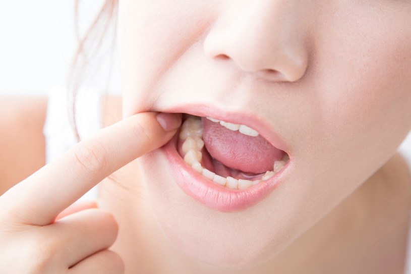 Podczas mycia zębów Polacy popełniają szereg błędów, które powtarzane przez lata skutkują  groźnymi konsekwencjami /123RF/PICSEL