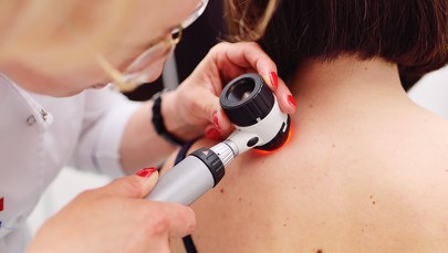 Podejrzane zmiany na skórze? We Wrocławiu zbadają je bezpłatnie