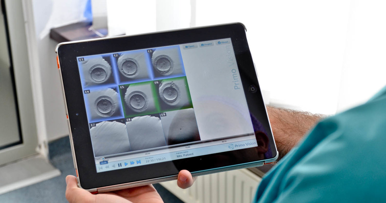 Podgląd metodą poklatkową zarodków na iPadzie /fot. Gyncetrum /materiały prasowe