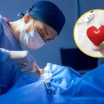 Podobnych operacji jest bardzo mało. Sukces wrocławian