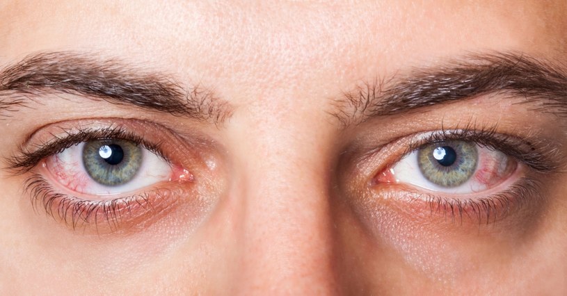Podrażnienia oczu może powodować klimatyzacja /123RF/PICSEL