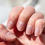 Pofalowana płytka paznokcia - jakie są przyczyny?