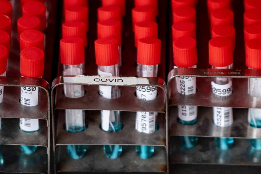 Pogarsza się sytuacja epidemiczna w Europie. Część państw zaostrzyła już koronawirusowe obostrzenia. /	David Tanecek /PAP/EPA