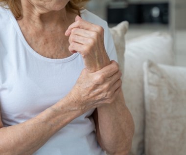 Pojawiają się na rękach, nogach i w okolicach oczu. To nietypowy objaw wysokiego cholesterolu 