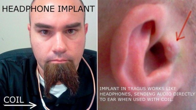 Pojawił się kolejny cyborg - tym razem z implantami w uszach /materiały prasowe