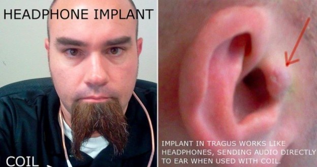 Pojawił się kolejny cyborg - tym razem z implantami w uszach /materiały prasowe