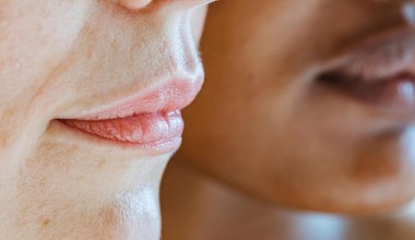 Pojawił się u ciebie delikatny wąsik? To najłagodniejsza metoda na usunięcie go