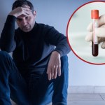 Pół roku leczył się na łuszczycę. Mężczyzna zmarł z powodu AIDS dzień po diagnozie