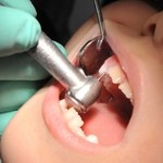 Polacy nie dbają o zęby. Ponad 90 proc. nastolatków ma próchnicę
