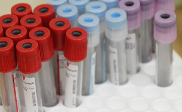 Polimer z Polski ostrzeże przed groźną chorobą nerek