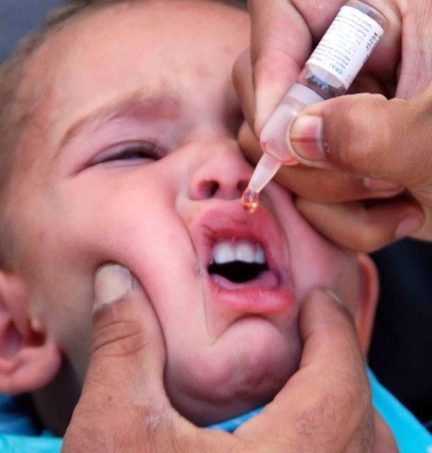 Polio jest chorobą zakaźną atakującą głównie dzieci do piątego roku życia. /AKHTER GULFAM /PAP/EPA