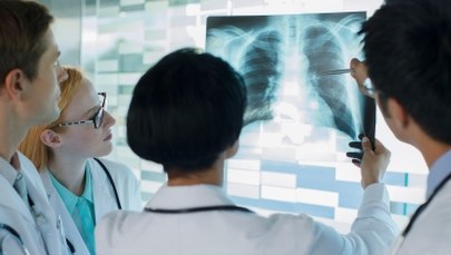 Polska ma najmniej lekarzy w UE. Stażyści zarabiają mniej niż kasjerzy