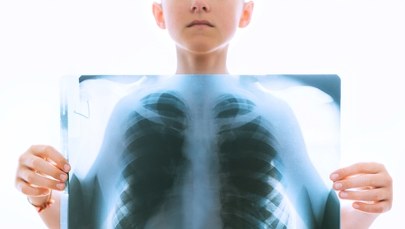 Ponad 180 dzieci przejdzie badania. Miały kontakt z nauczycielką chorą na gruźlicę