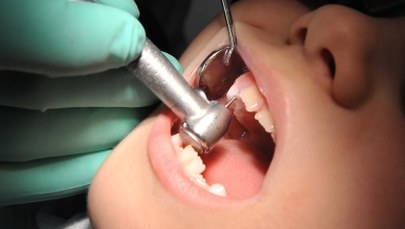 Ponad trzy tysiące zarzutów dla dentysty. Chodzi o wyłudzenia refundacji