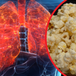 Popcornowe płuca zapierają dech. Prowadzą do niewydolności płuc lub serca