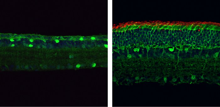 Porównanie komórek siatkówki u myszy cierpiącej na zwyrodnienie barwnikowe (po lewej) i poddanej terapii (po prawej) /© 2023 Qin et al. Originally published in Journal of Experimental Medicine. https://doi.org/10.1084/jem.20220776 /Materiały prasowe