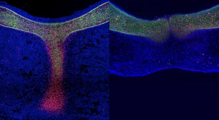Porównanie rozwoju mostka u kury i emu /Yuji Atsuta / Kyushu University /Materiały prasowe