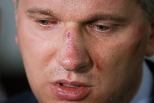 Poseł twierdzi, że został brutalnie pobity przez policjantów /Paweł Supernak /PAP